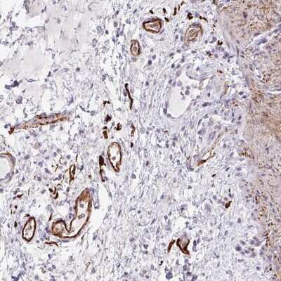 Immunohistochemistry-Paraffin: TEM Antibody [NBP1-89939]