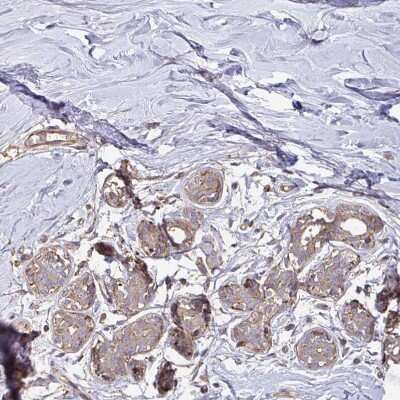Immunohistochemistry-Paraffin: TEM Antibody [NBP2-49189]
