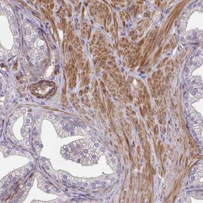 Immunohistochemistry-Paraffin: TEM Antibody [NBP2-49189]