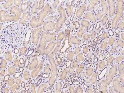 Immunohistochemistry-Paraffin: TEM Antibody [NBP2-97326]