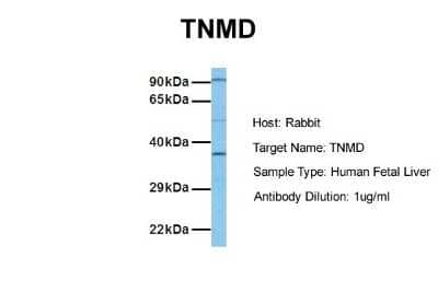 Western Blot: TEM Antibody [NBP1-70722]