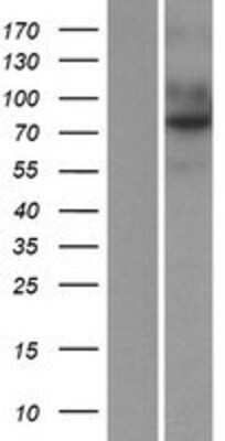 Western Blot: Endosialin/CD248/TEM1 Overexpression Lysate [NBP2-06637]