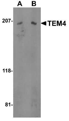 Western Blot: TEM4 AntibodyBSA Free [NBP1-77314]