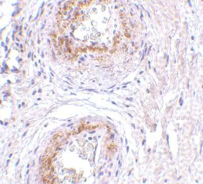 Immunohistochemistry-Paraffin: TEM5/GPR124 Antibody - BSA Free [NBP1-77315]
