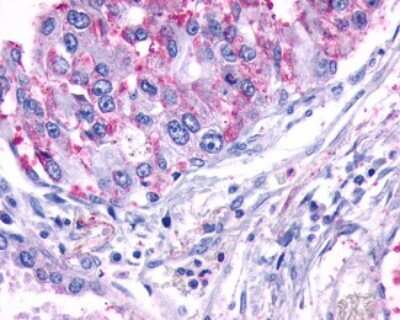 Immunohistochemistry-Paraffin: TEM5/GPR124 Antibody - BSA Free [NLS2167]