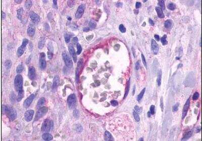 Immunohistochemistry-Paraffin: TEM5/GPR124 Antibody - BSA Free [NLS2167]