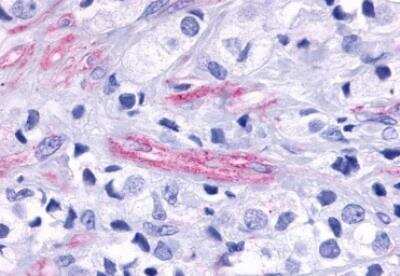 Immunohistochemistry-Paraffin: TEM5/GPR124 Antibody - BSA Free [NLS2167]