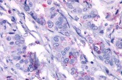 Immunohistochemistry-Paraffin: TEM5/GPR124 Antibody - BSA Free [NLS2167]