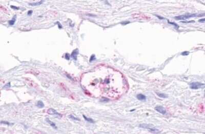 Immunohistochemistry-Paraffin: TEM5/GPR124 Antibody - BSA Free [NLS2171]