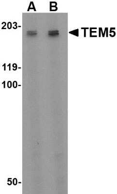 Western Blot: TEM5/GPR124 AntibodyBSA Free [NBP1-76844]