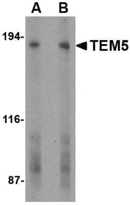 Western Blot: TEM5/GPR124 AntibodyBSA Free [NBP1-77315]