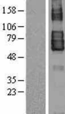 Western Blot: TEM7/PLXDC1 Overexpression Lysate [NBL1-14532]