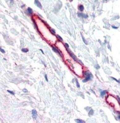 Immunohistochemistry: TEM7/PLXDC1 Antibody (197C193 (IM193)) - Azide Free [NBP2-33228]