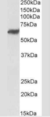 Western Blot: TEM7/PLXDC1 Antibody (197C193 (IM193))Azide Free [NBP2-33228]