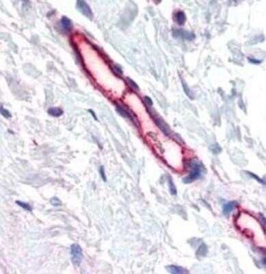 Immunohistochemistry-Paraffin: TEM7/PLXDC1 Antibody (197C193 (IM193)) - BSA Free [NB100-56557]
