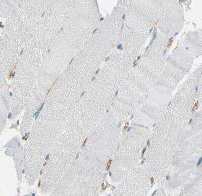 Immunohistochemistry-Paraffin: TEM7/PLXDC1 Antibody [NBP1-86954]