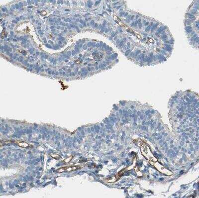 Immunohistochemistry-Paraffin: TEM7/PLXDC1 Antibody [NBP1-86954]
