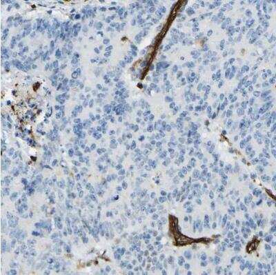 Immunohistochemistry-Paraffin: TEM7/PLXDC1 Antibody [NBP1-86954]