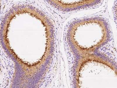 Immunohistochemistry-Paraffin: TEM7/PLXDC1 Antibody [NBP2-97892]