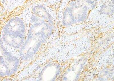 Immunohistochemistry-Paraffin: TEM8/ANTXR1 Antibody (200C1339(SB20)) - Azide and BSA Free [NBP2-33232]
