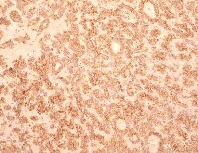 Immunohistochemistry-Paraffin: TEM8/ANTXR1 Antibody (200C1339(SB20)) - Azide and BSA Free [NBP2-33232]