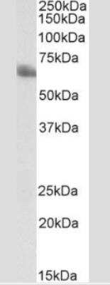 Western Blot: TEM8/ANTXR1 Antibody (200C1339(SB20))Azide and BSA Free [NBP2-33232]