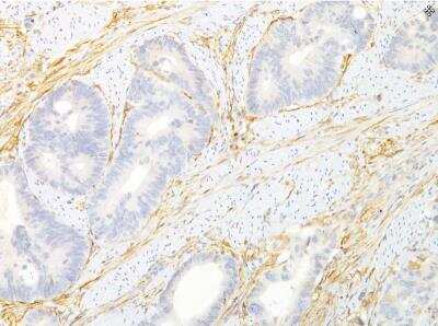 Immunohistochemistry-Paraffin: TEM8/ANTXR1 Antibody (200C1339(SB20)) - BSA Free [NB100-56585]
