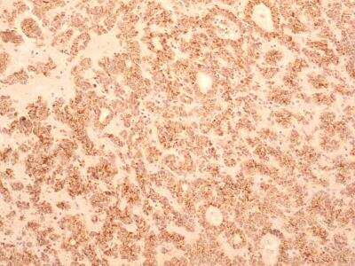 Immunohistochemistry-Paraffin: TEM8/ANTXR1 Antibody (200C1339(SB20)) - BSA Free [NB100-56585]