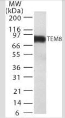 Western Blot: TEM8/ANTXR1 Antibody (200C1339(SB20))BSA Free [NB100-56585]