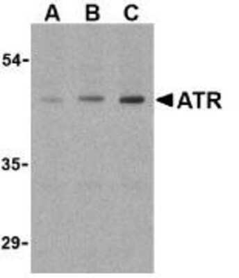 Western Blot: TEM8/ANTXR1 AntibodyBSA Free [NBP1-77233]