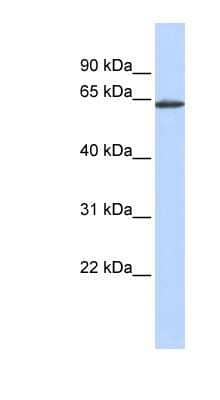 Western Blot: TEM8/ANTXR1 Antibody [NBP1-62488]