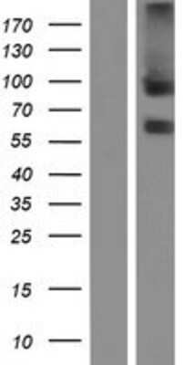 Western Blot: TEM8/ANTXR1 Overexpression Lysate [NBL1-07554]