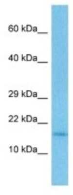 Western Blot: TEN1 Antibody [NBP3-10120]