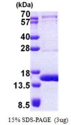 SDS-PAGE: Recombinant Human TEN1 His Protein [NBP2-22855]