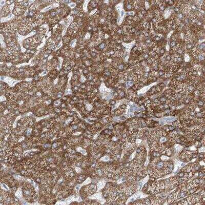 Immunohistochemistry: TENC1 Antibody [NBP1-90698]