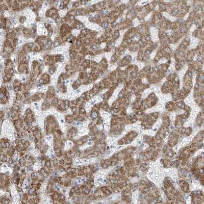 Immunohistochemistry-Paraffin: TENC1 Antibody [NBP1-90698]