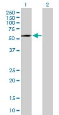 Western Blot: TENR Antibody [H00132612-B01P]