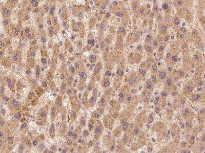 Immunohistochemistry-Paraffin: TEP1 Antibody [NBP3-05903]