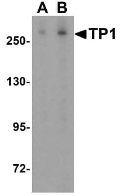 Western Blot: TEP1 AntibodyBSA Free [NBP1-77285]