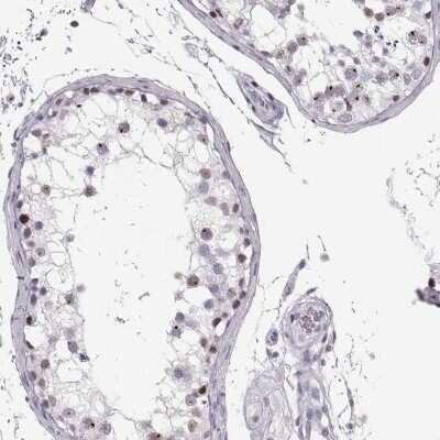 Immunohistochemistry-Paraffin: TEPP Antibody [NBP2-57214]