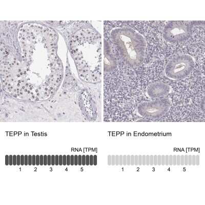 Immunohistochemistry-Paraffin: TEPP Antibody [NBP2-57214]