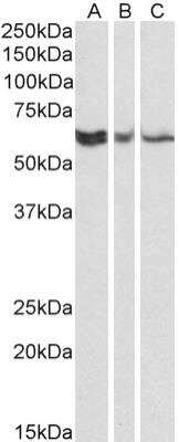 Western Blot: TERF2IP Antibody (78B356.1) [NB100-56526]