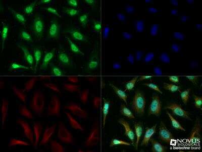 Immunocytochemistry/ Immunofluorescence: TERF2IP Antibody [NB100-56321]