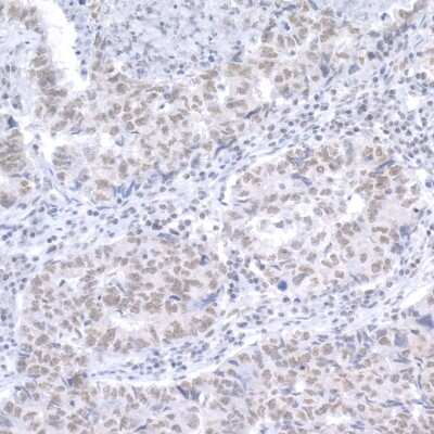 Immunohistochemistry-Paraffin: TERF2IP Antibody [NB100-292]