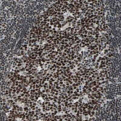 Immunohistochemistry-Paraffin: TERF2IP Antibody [NBP1-82433]