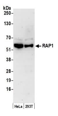 Western Blot: TERF2IP Antibody [NB100-292]