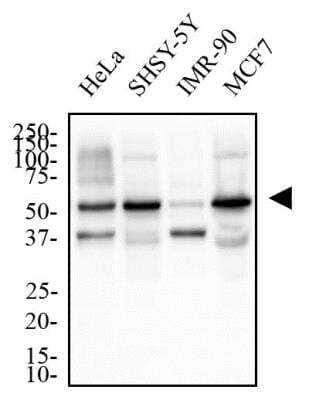 Western Blot: TERF2IP Antibody [NB100-56321]