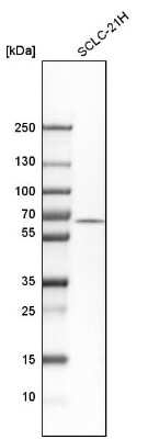 Western Blot: TERF2IP Antibody [NBP1-82433]