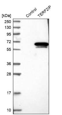 Western Blot: TERF2IP Antibody [NBP1-82433]