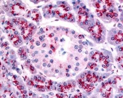 Immunohistochemistry: TERT Antibody (2C4) - Azide and BSA Free [NBP2-80975]